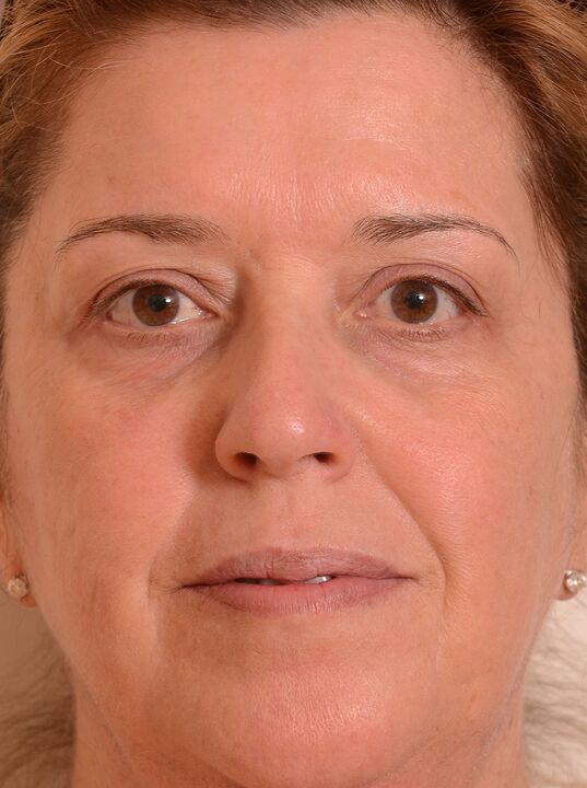 Ich habe mein Gesicht mit Eudalie -Creme verjüngt